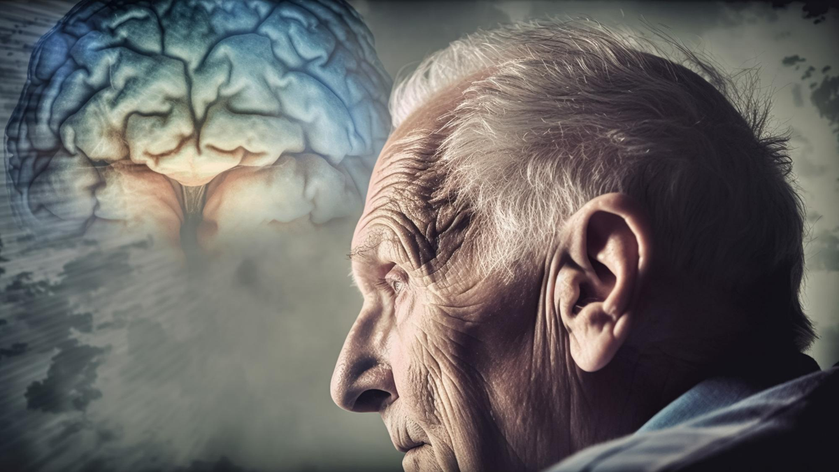 Áttörést hozhat egy új szűrővizsgálat az Alzheimer-kór diagnosztikájában
