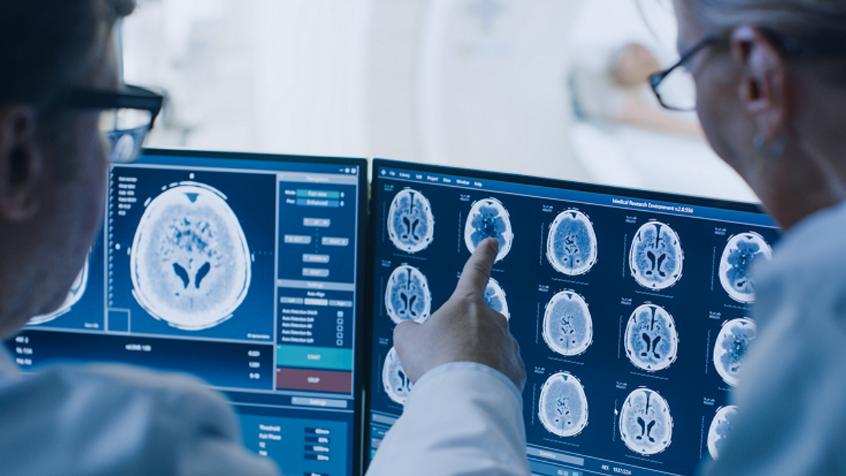 Hatalmas áttörés az Alzheimer-szűrésben – Videó!
