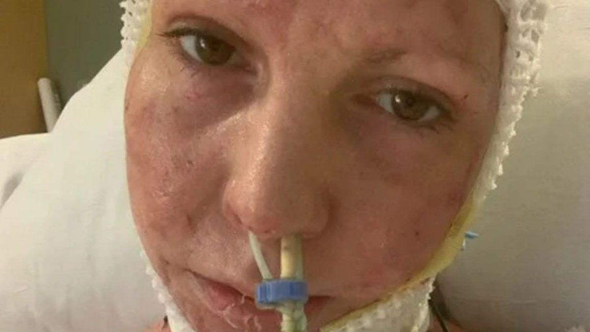 „Hat héttel egy buli után arra ébredtem a kórházban, hogy megégettem a testem felét”
