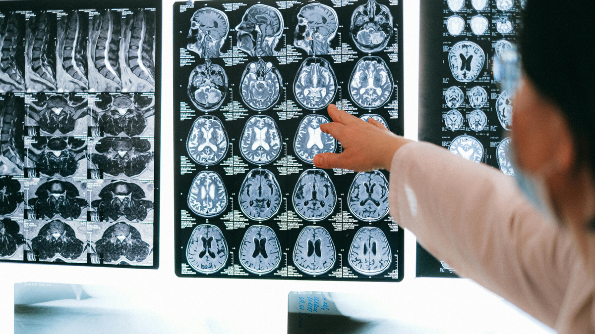 Szomszédja szúrta ki az agydaganatát, ezek voltak az árulkodó jelek