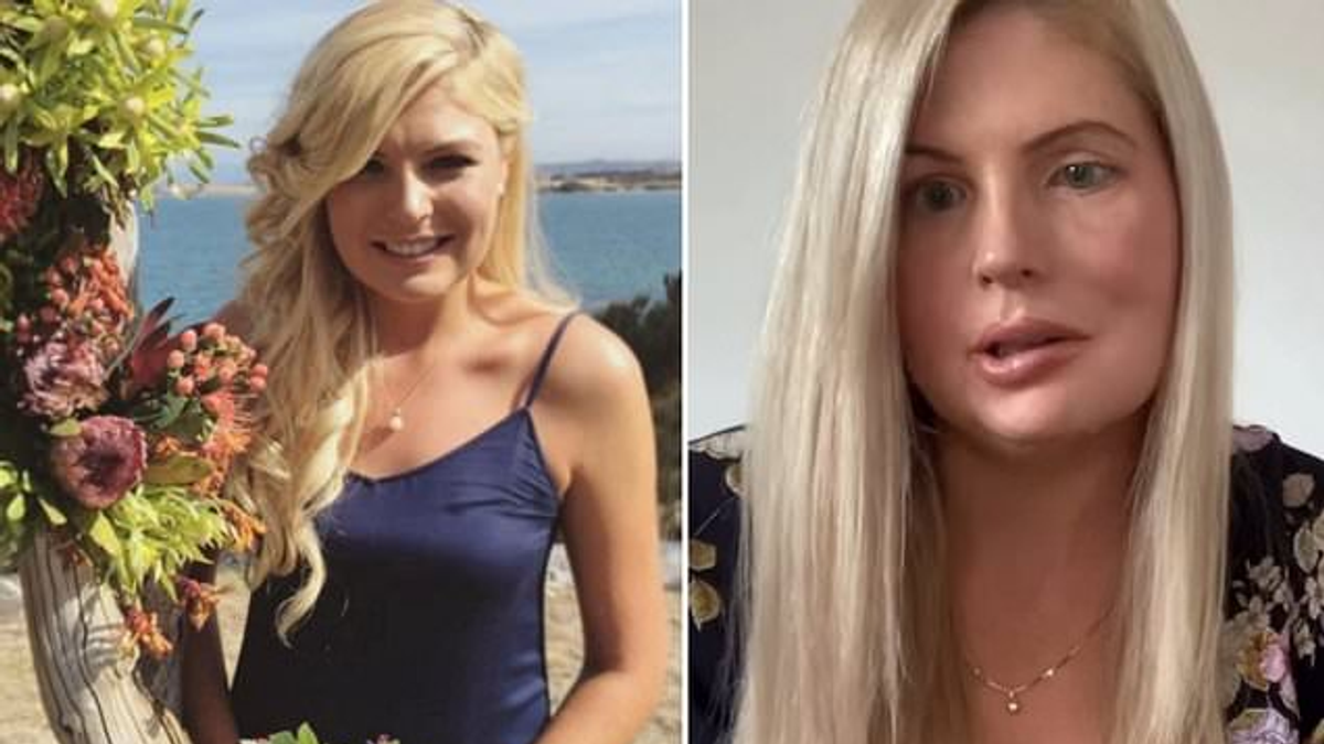 Az egészséges 21 éves Tina sokkoló stroke-ot szenvedett, ezek voltak az apró tünetei