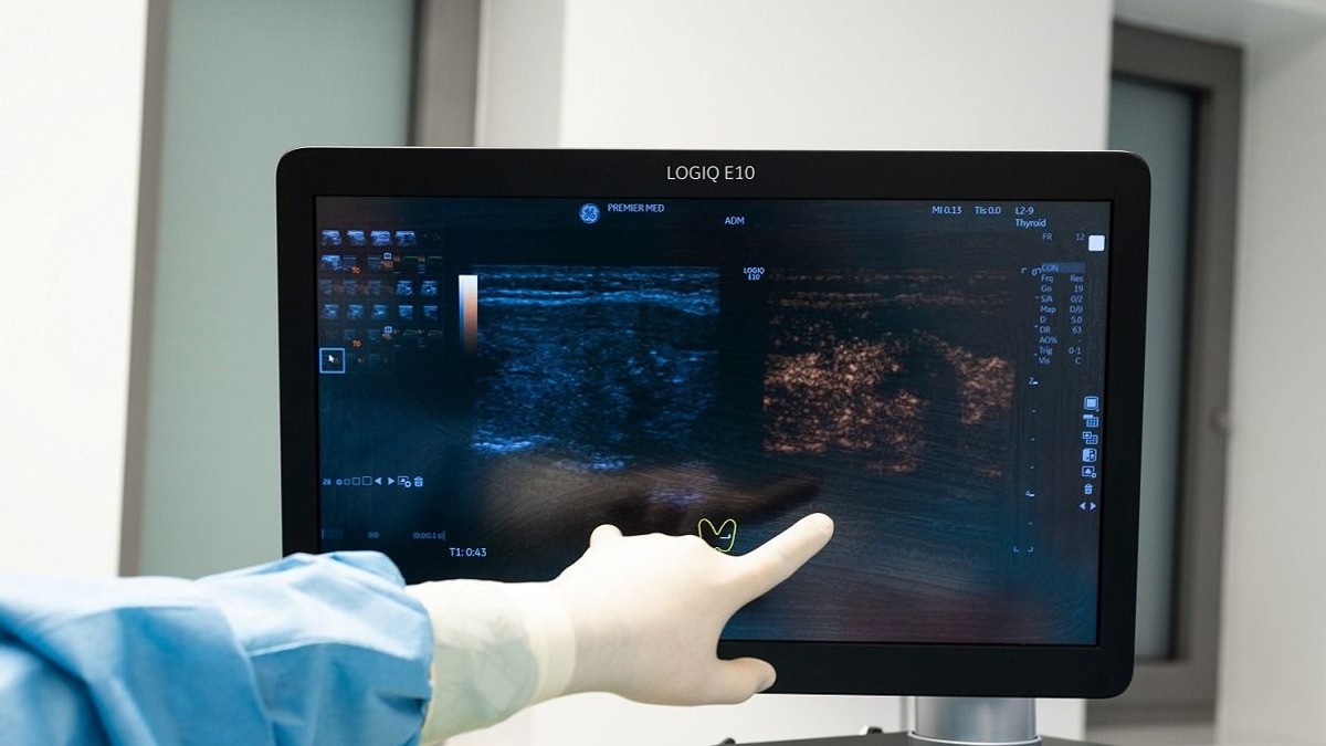 Áttörés a pajzsmirigyrák kezelésében: magyar kutatás új technológia segítségével hozhat gyorsabb, biztonságosabb gyógyulást