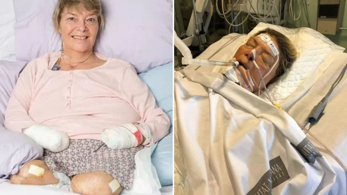 Felfázott az édesanya, mind a négy végtagját elvesztette: „Azt hittem, meg fogok halni”