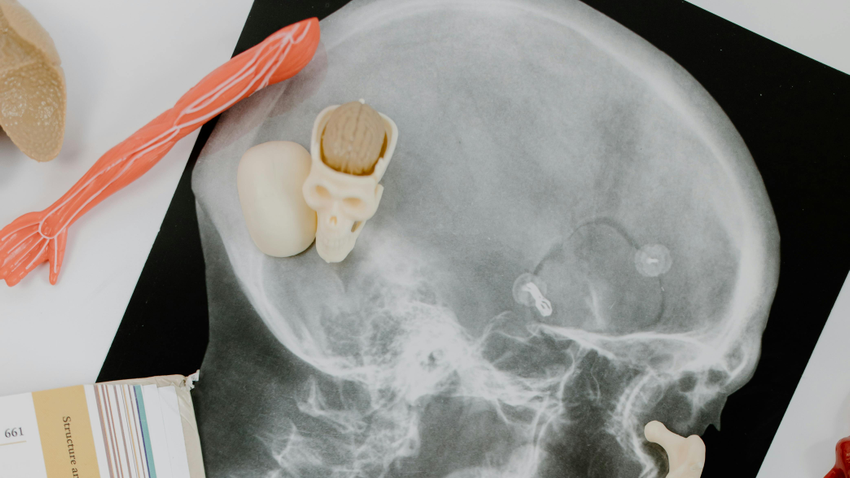 Kvíz kérdést ábrázoló kép.