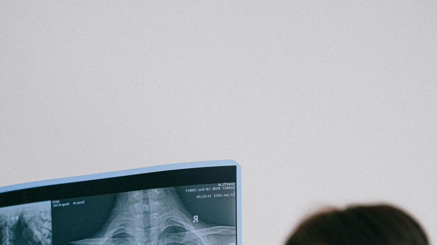 Kvíz kérdést ábrázoló kép.