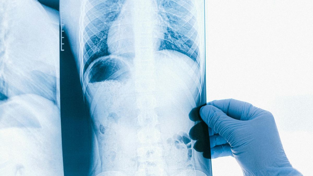 Egy anyának eltávolították a tüdeje egy részét, miután rákot diagnosztizáltak nála