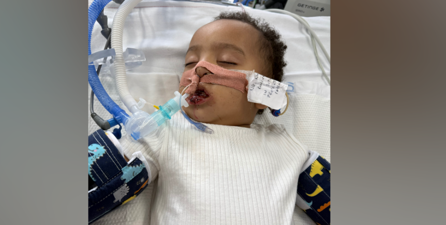 Égési sérüléseket szenvedett a lefolyótisztítótól. Kép: GoFundMe