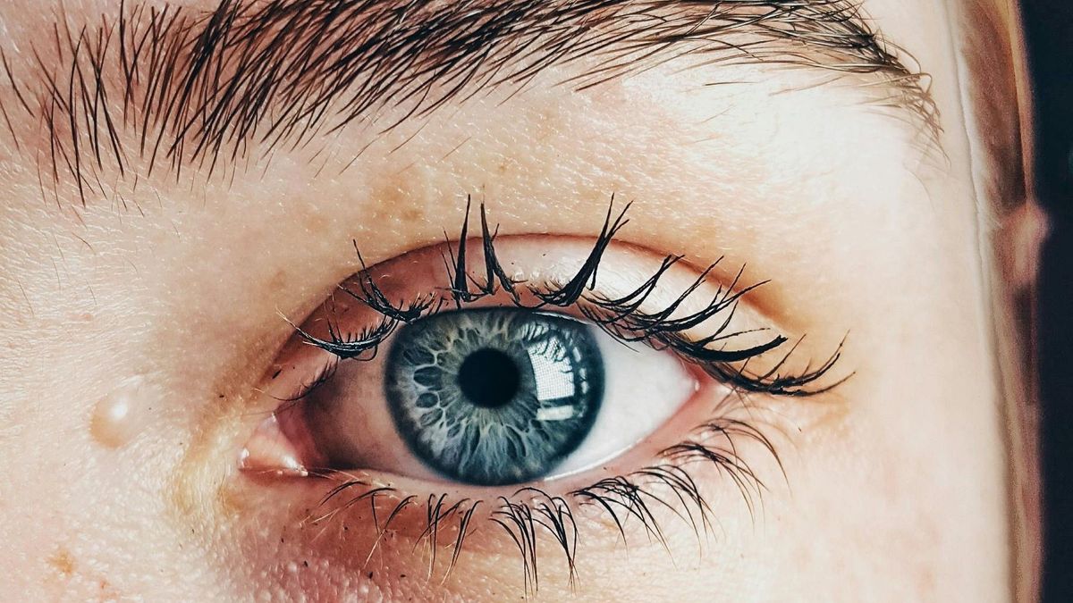 Veszélyesek lehetnek a koleszterin-problémák