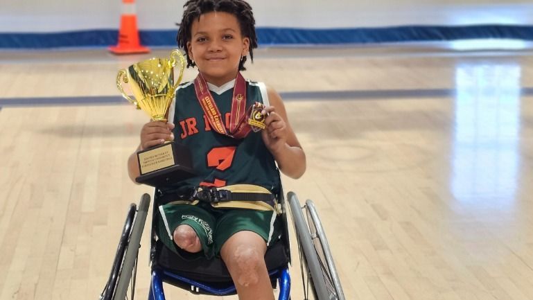 Influenza miatt mindkét lábát amputálni kellett a kisfiúnak