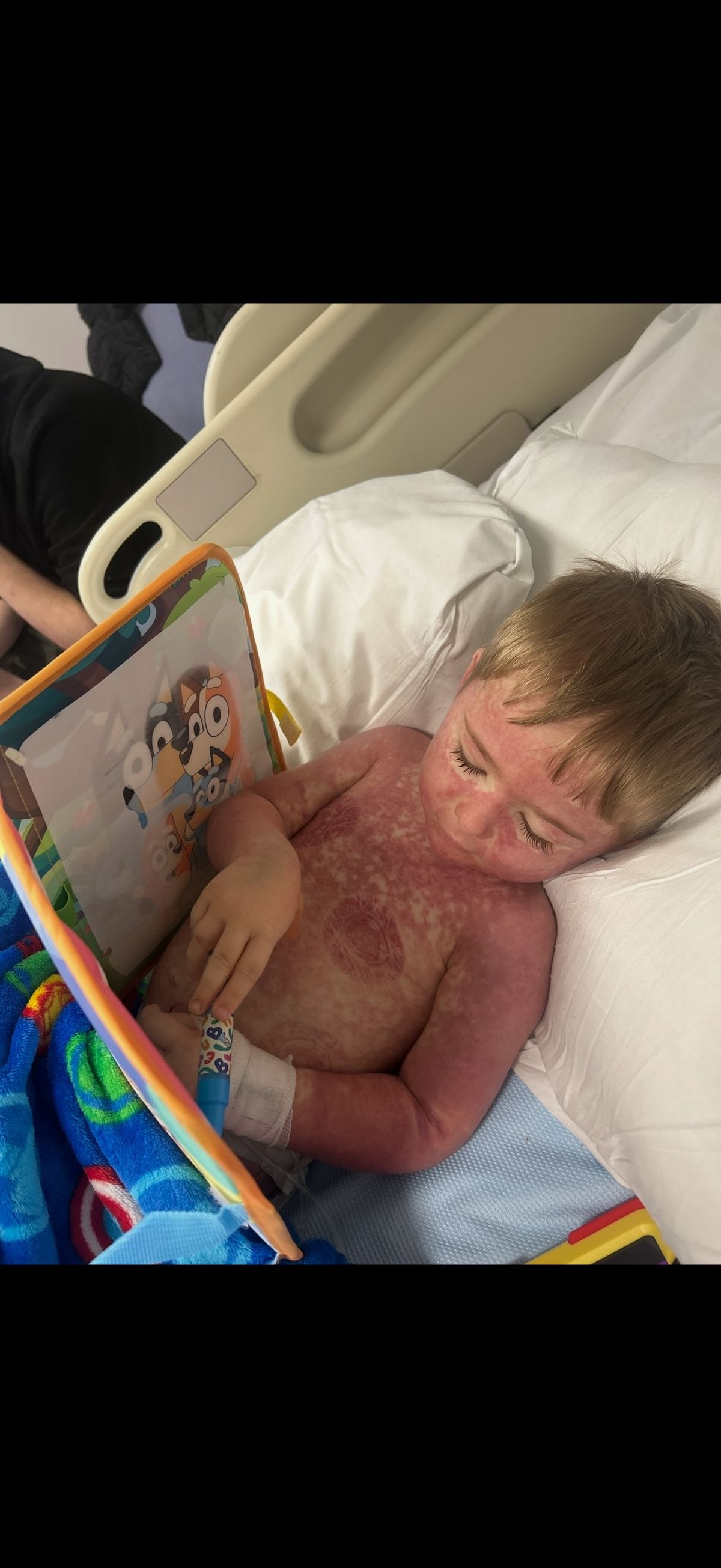 Csak az életmentő műtét segíthet a gyereken