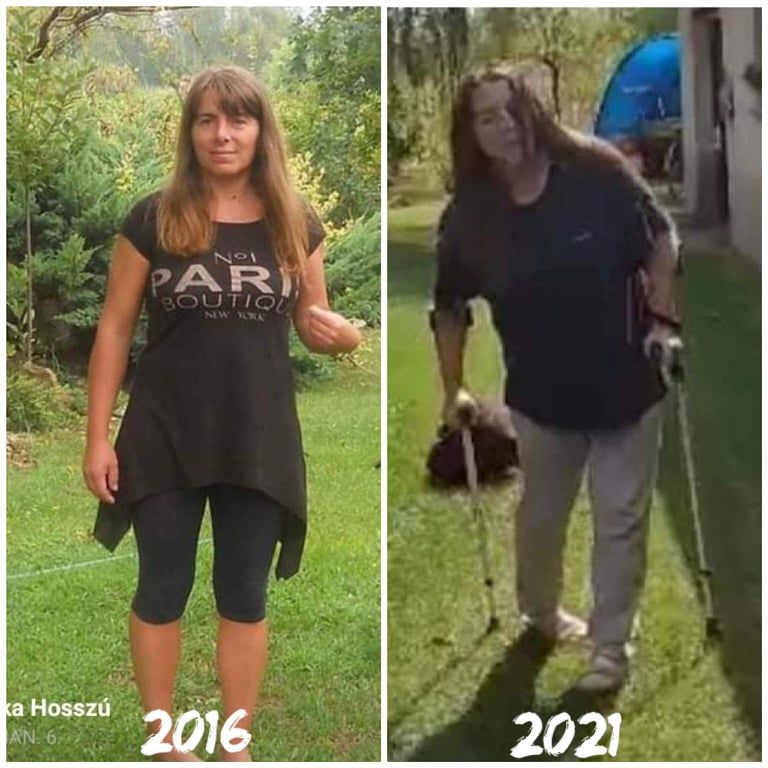 Teknyős Pálné Hosszú Mónika állapota sokat romlott az évek alatt