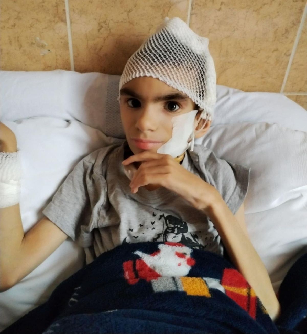 Viktorka a vesetranszpalntáció után a kórházban