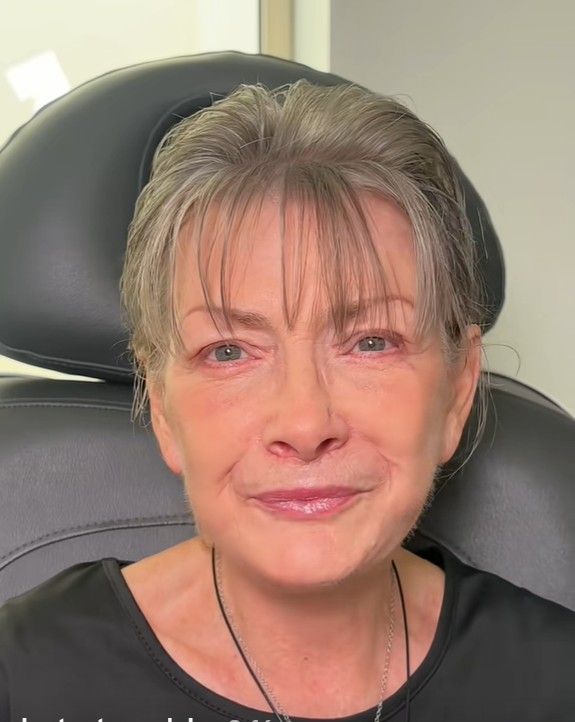 átváltozás, plasztikai sebész