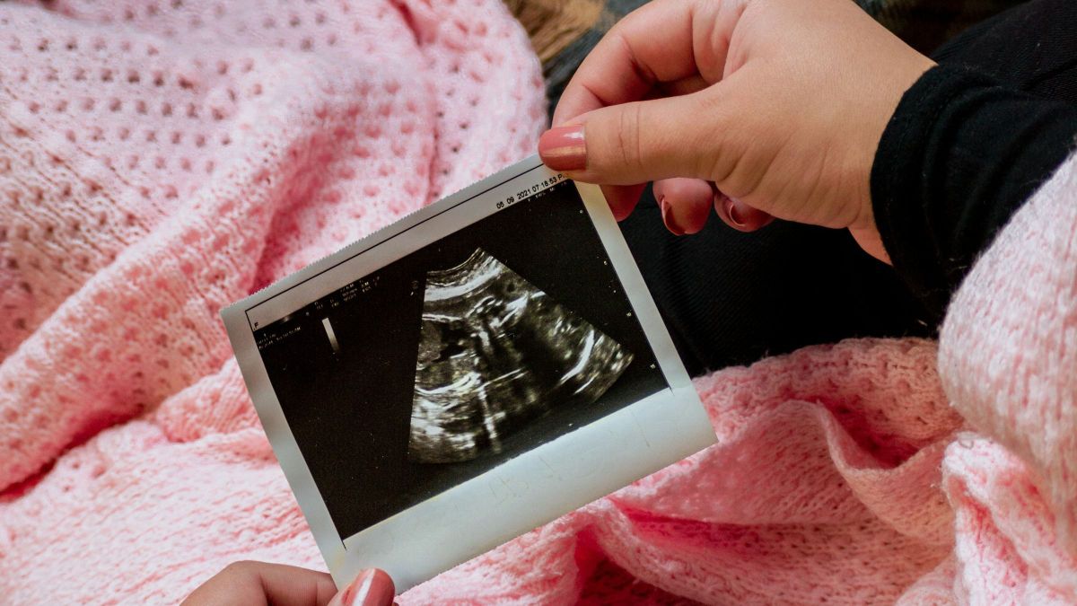 A lombikbébi program családok milliónak adott reményt a gyermekvállalás kapcsán