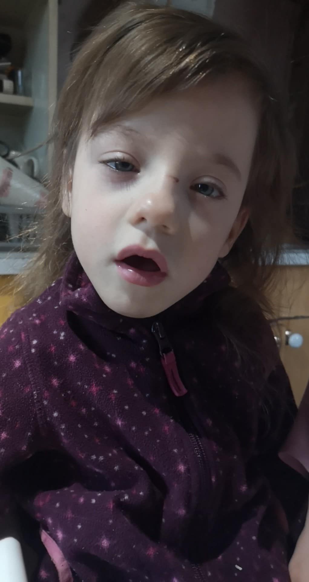 Már csak karnyújtásnyira a csoda: 300 ezer forint hiányzik Csenge gyógyulásához. Egy önzetlen asszony a születésnapi ajándékai helyett a kislánynak kér támogatást.