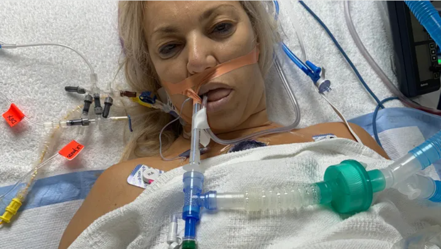 Betegségek sorozatához vezetett a nő mellimplantátuma. 