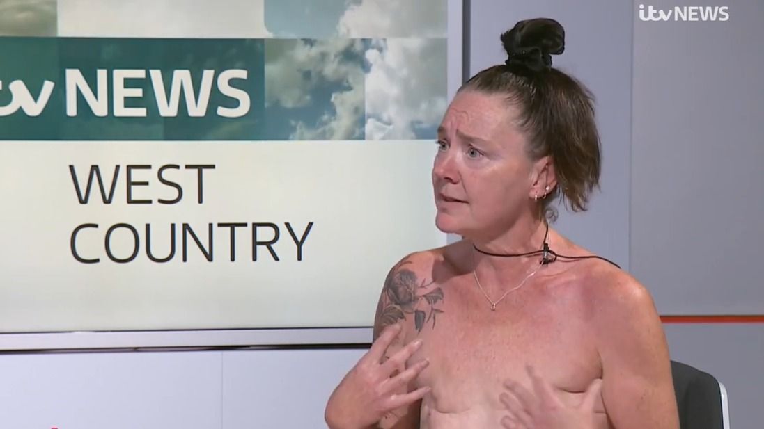 Louise Butcher nem hagyta, hogy a mellrák és a kettős masztektómia megtörje: ma már büszkén mutatja meg hegeit a világnak