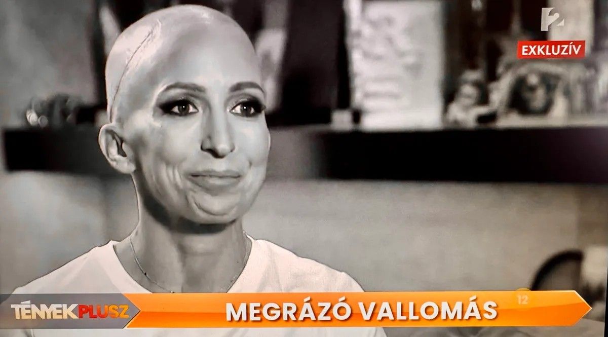 Rubint Réka fájdalmas őszinteséggel beszélt állapotáról