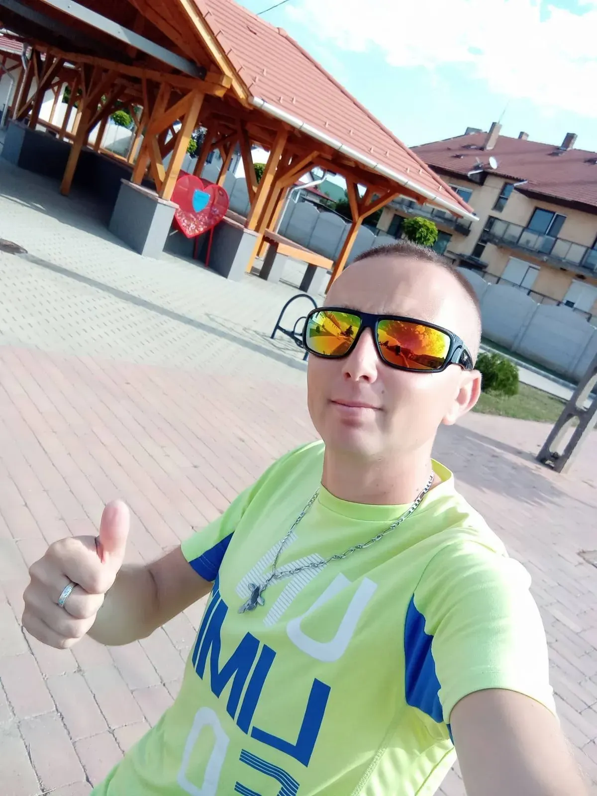 Siklós Csaba, a transzplantált TikTok-sztár